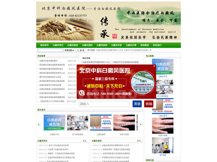 儿童白癜风症状_儿童白斑初期症状_江西南昌治疗儿童白癜风医院_白癜风症状【白癜风医院】