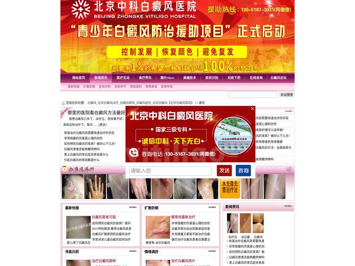 白癜风_北京白癜风治疗_白癜风医院_白癜风症状_北京白癜风【北京白癜风医院】
