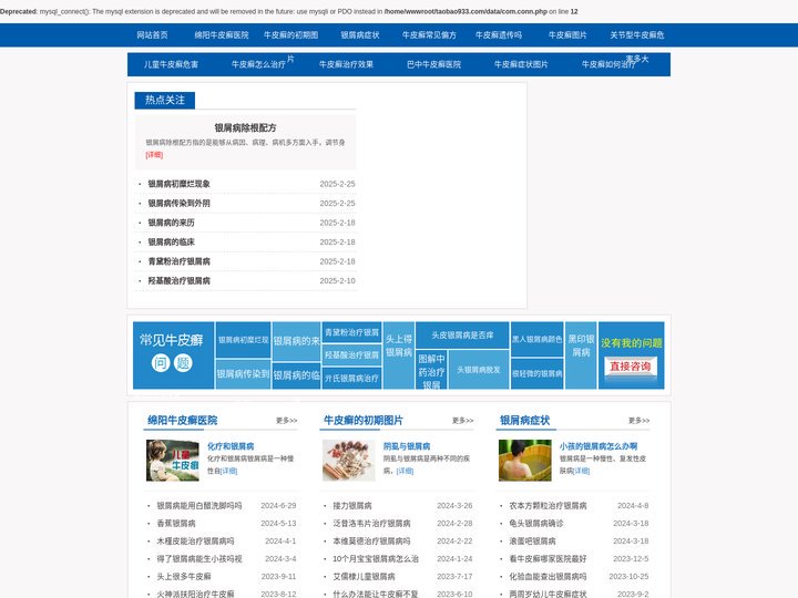 成都牛皮癣专科医院_成都牛皮癣医院哪家好_成都治疗牛皮癣的医院_成都银康银屑病医院