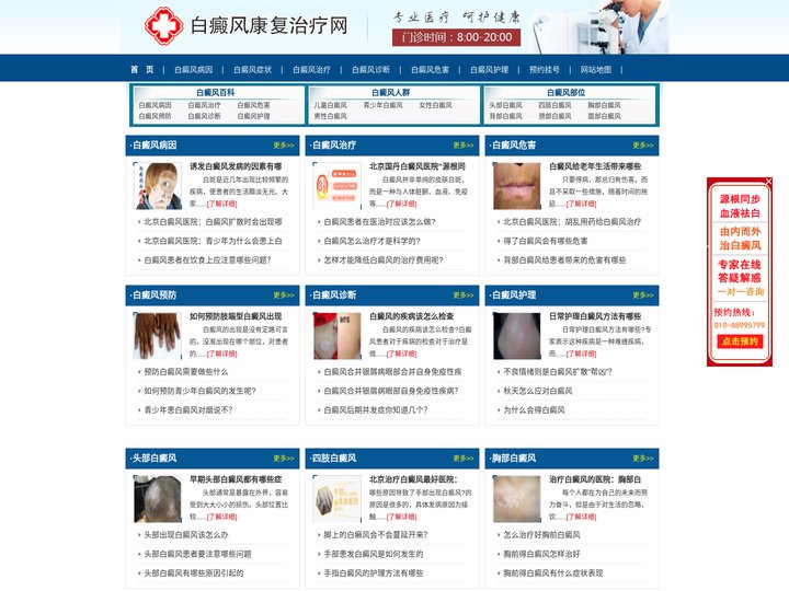 白癜风怎么治疗_白癜风的治疗_治疗白癜风最好医院