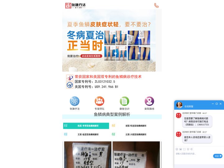 鱼鳞病 | 鱼鳞皮肤病 | 鱼鳞病皮肤病医院 | 张建疗法官网