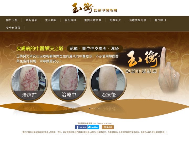 玉衡乾癬中醫集團 -乾癬治療,彰化乾癬治療 中醫青黛膏治療乾癬異位性皮膚炎濕疹玉衡中醫集團彰化玉衡中醫台北玉衡中醫桃園玉